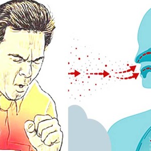 ८६४ जनाको क्षयरोग परीक्षण गर्दा १६ जना बिरामी फेला