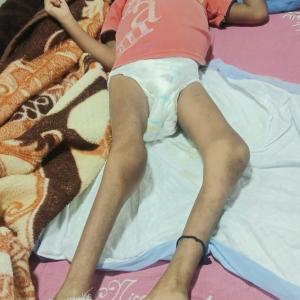 पाँच वर्षीय उज्वलको उपचारमा आर्थिक अभाव, सहयोगका लागि परिवारको अपिल